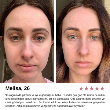 60 Adet Göz Altı Aydınlatıcı, Sıkılaştırıcı Ve Onarıcı Maske 1.4gr*60 Adet altın